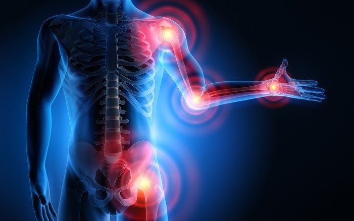Joint Pain Areas